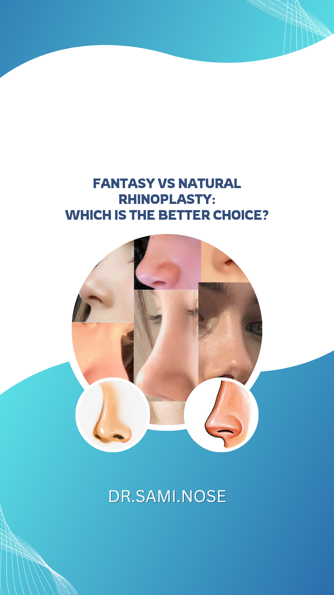 fantasy-vs-natural-rhinoplasty | dr-sami